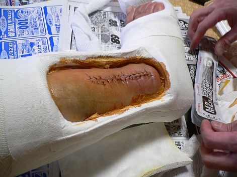 これから、縫合部の消毒…こんな写真でゴメンナサイ!! これから、縫合部の消毒…こんな写真でゴメンナサイ!!の画像